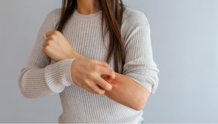 Allergy or Asthma Symptoms